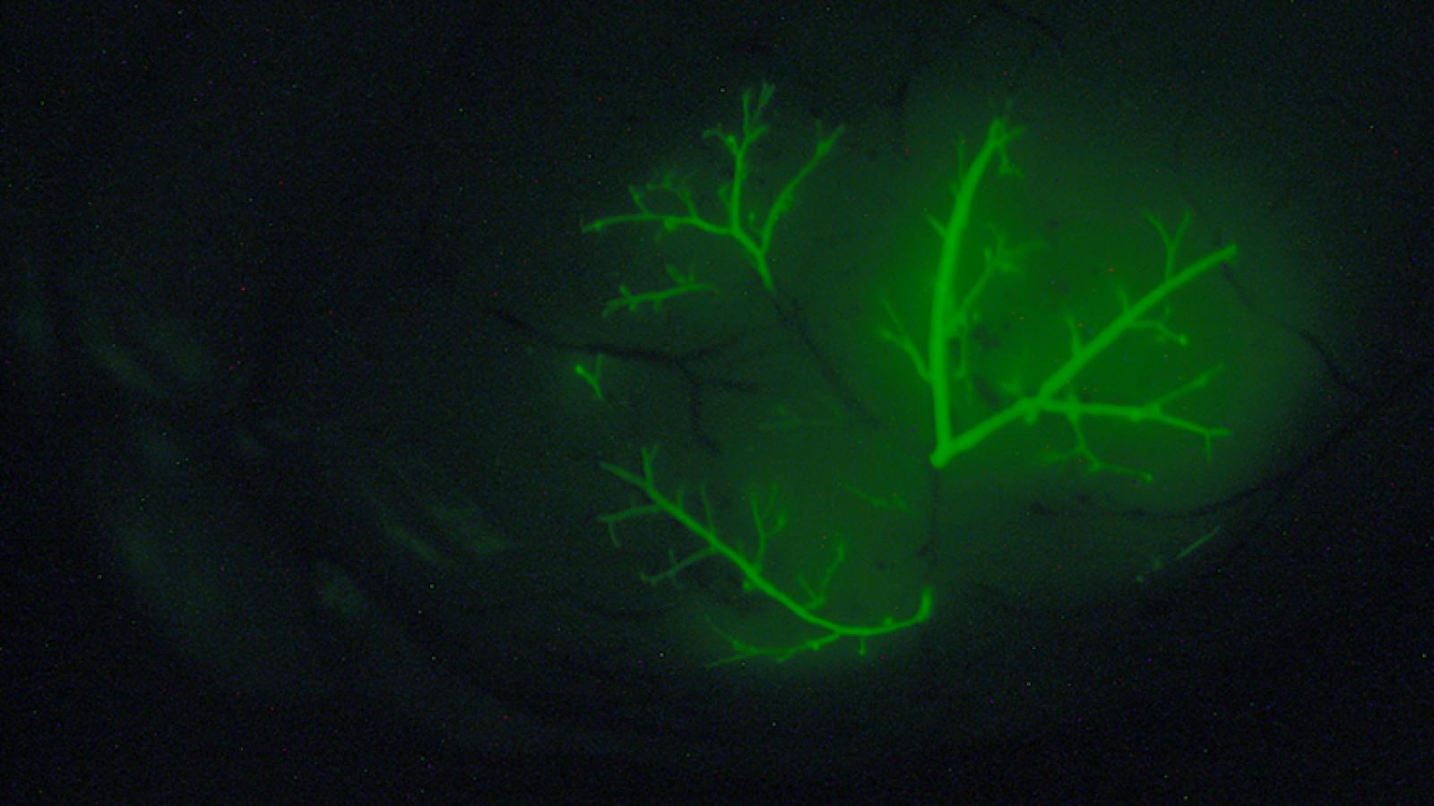 Image of a brain metastasis from a mouse model of metastatic prostate cancer